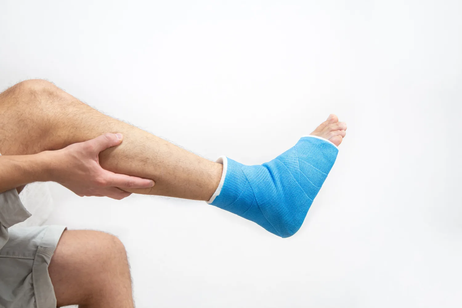 Atención de fracturas en Guadalajara con EBM Servicios Ortopédicos Profesionales
